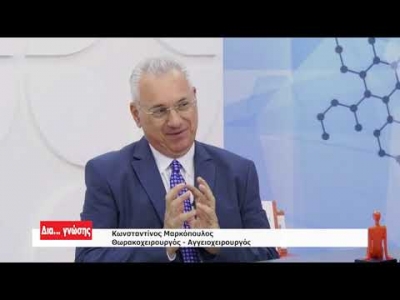 Φλεβική Ανεπάρκεια: Όσα πρέπει να ξέρετε